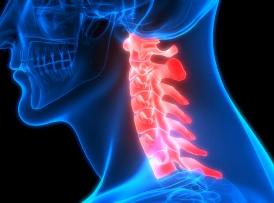La cervicalgia: cause e rimedi  alle problematiche più comuni
