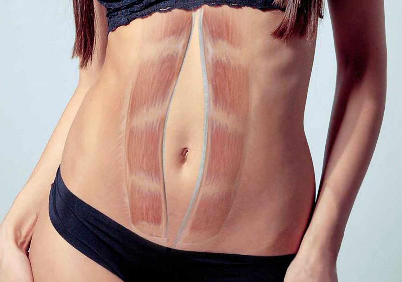 La Diastasi addominale: cos’è, fattori di rischio e come la fisioterapia può aiutare